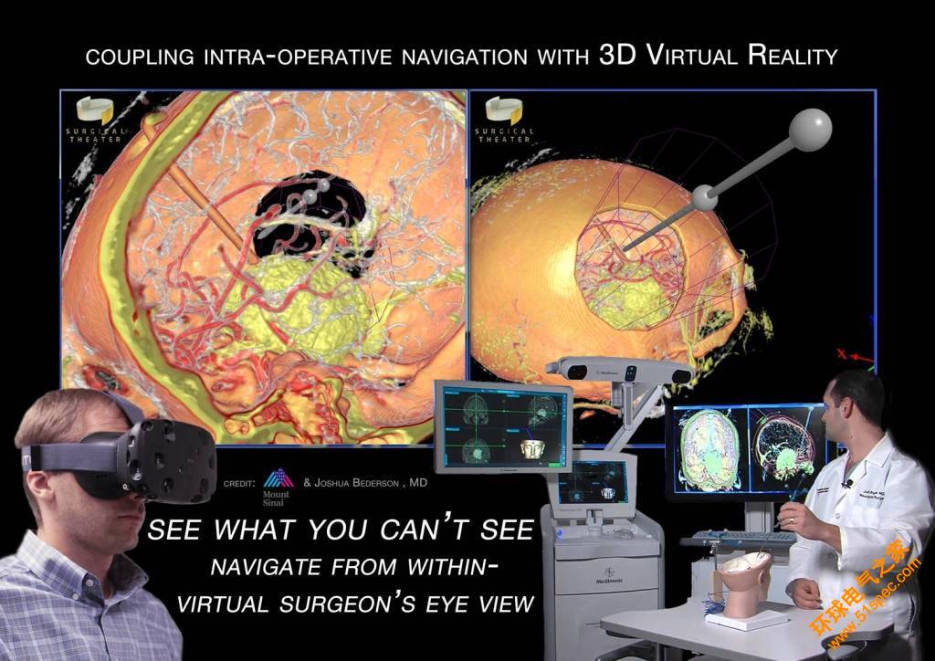 通过AR/VR技术让你明白医生要怎么捣鼓你的脑子（视频）