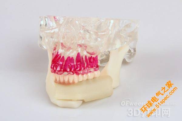 3D Systems推出牙科虛擬手術規劃解決方案
