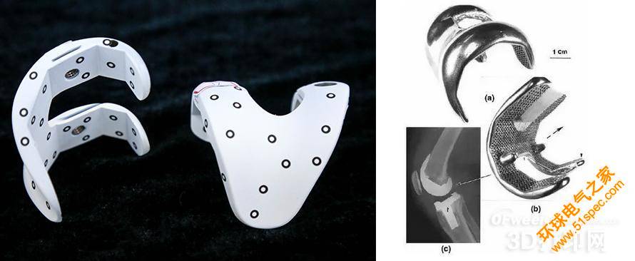 粉床熔融3D打印技术在医疗植入体制造中的应用