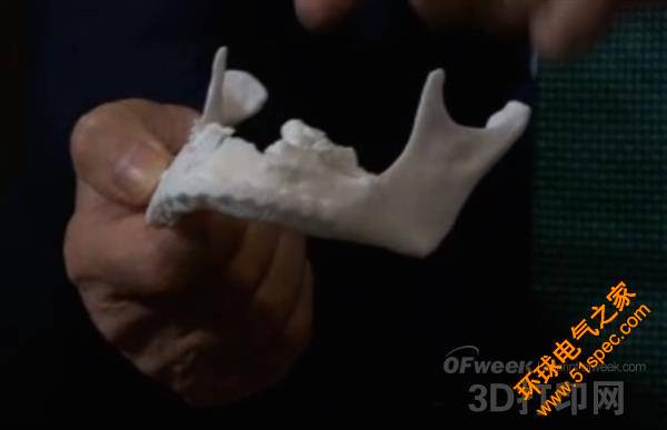 醫生利用3D打印技術為車禍傷者重新創建下頜